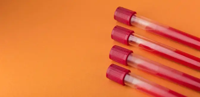 Hemograma Completo: Entenda quais exames são realizados